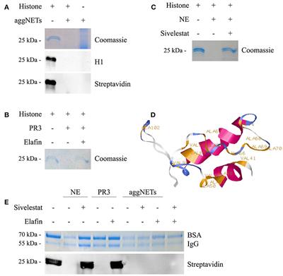 Aggregated NETs Sequester and Detoxify Extracellular Histones